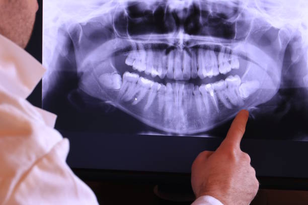 Best Tooth Pain Emergency Relief  in Manton, MI